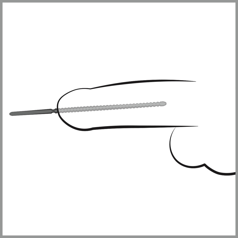 Dip Stick Ripped 6mm - Dilatador Uretral Acero Inoxidable Penisplug